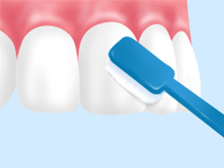 プラークコントロール（ブラッシング）