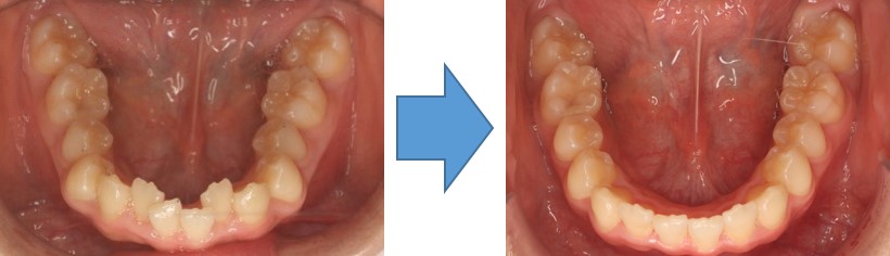 図1